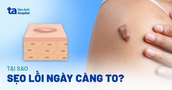 Hình ảnh minh họa tổng kết về việc sử dụng thuốc đông y trị sẹo lồi