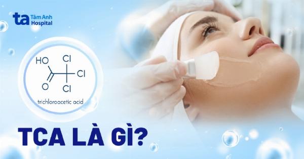 Bảng so sánh ưu và nhược điểm của phương pháp chấm TCA trong điều trị sẹo đáy nhọn.