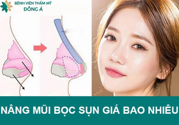 Vân Tiny sửa mũi ở đâu và tầm quan trọng của việc chọn địa chỉ nâng mũi uy tín