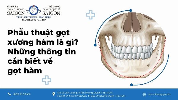 Hinh anh minh hoa dang mui dep tu nhien, hai hoa voi khuon mat (co the la hinh mo phong hoac truoc sau cua khach hang da duoc su dong y, lam mo mat)